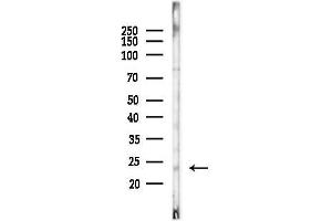 anti-Placenta Growth Factor (PGF) (Internal Region) antibody