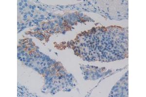 IHC-P analysis of Kidney tissue, with DAB staining. (XCR1 anticorps  (AA 43-222))
