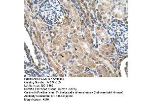 Human kidney (FLJ22167 (N-Term) anticorps)