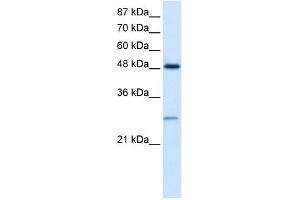 WB Suggested Anti-CLIC4 Antibody Titration:  2. (CLIC4 anticorps  (N-Term))