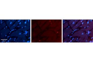 Rabbit Anti-RING1 Antibody Catalog Number: ARP33227_P050 Formalin Fixed Paraffin Embedded Tissue: Human heart Tissue Observed Staining: Nucleus Primary Antibody Concentration: 1:100 Other Working Concentrations: 1:600 Secondary Antibody: Donkey anti-Rabbit-Cy3 Secondary Antibody Concentration: 1:200 Magnification: 20X Exposure Time: 0. (RING1 anticorps  (Middle Region))