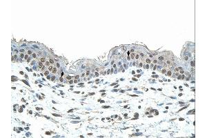 Immunohistochemistry (IHC) image for anti-SMAD, Mothers Against DPP Homolog 1 (SMAD1) (N-Term) antibody (ABIN2780719)