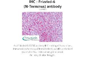 Image no. 2 for anti-Frizzled Family Receptor 6 (FZD6) (Extracellular Domain), (N-Term) antibody (ABIN1734469) (FZD6 anticorps  (Extracellular Domain, N-Term))
