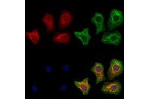 ABIN6265718 and ABIN6273333 staining Hela cells by IF/ICC.