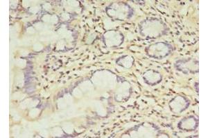 Immunohistochemistry of paraffin-embedded human small intestine tissue using ABIN7173373 at dilution of 1:100