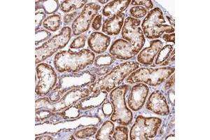 Immunohistochemical staining of human kidney with BCO2 polyclonal antibody  shows strong cytoplasmic positivity in renal tubules at 1:50-1:200 dilution. (BCO2 anticorps)