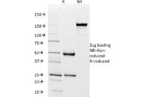 SDS-PAGE Analysis Purified IgD Mouse Monoclonal Antibody (IGD26). (IgD anticorps)