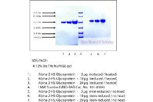 Gel Scan of Alpha 2 HS Glycoprotein, Human Plasma  This information is representative of the product ART prepares, but is not lot specific. (Fetuin A Protéine)