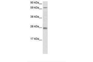 Image no. 1 for anti-Reproductive Homeobox 11 (RHOX11) (AA 61-110) antibody (ABIN6736075) (RHOX11 anticorps  (AA 61-110))