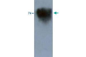 Western blot analysis in mouse brain tissue extract using Kcnd3 polyclonal antibody . (KCND3 anticorps)