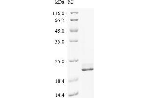 Estrogen Receptor 1 (ESR1) (AA 89-230) protein (His-ABP Tag)
