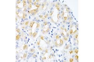 Immunohistochemistry of paraffin-embedded human stomach using CGB antibody. (Chorionic Gonadotropin, beta Polypeptide 3 (CGB3) anticorps)