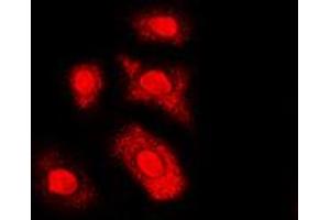 Immunofluorescent analysis of AKT (pT308) staining in HL60 cells. (AKT1 anticorps  (pSer308))