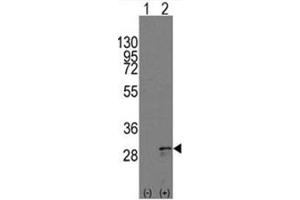 Image no. 2 for anti-KIT Ligand (KITLG) (C-Term) antibody (ABIN357009) (KIT Ligand anticorps  (C-Term))