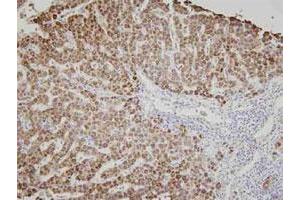 Immunohistochemistry of human liver tissue was incubated with AK3 monoclonal antibody , clone SJB3 - 36 (1 : 100)  for 2 hours at room temperature. (Adenylate Kinase 3 anticorps)