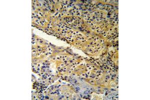 SPINK5 Antibody (N-term) (R) IHC analysis in formalin fixed and paraffin embedded human tonsil tissue followed by peroxidase conjugation of the secondary antibody and DAB staining. (SPINK5 anticorps  (N-Term))