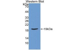 Western Blotting (WB) image for anti-Retinoic Acid Receptor Responder (Tazarotene Induced) 2 (RARRES2) (AA 21-155) antibody (ABIN1862319) (Chemerin anticorps  (AA 21-155))