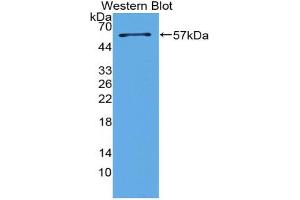 Western blot analysis of the recombinant protein. (Surfactant Protein A1 anticorps  (AA 21-248))