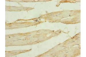 Immunohistochemistry of paraffin-embedded human skeletal muscle tissue using ABIN7175519 at dilution of 1:100 (Vinexin anticorps  (AA 1-329))