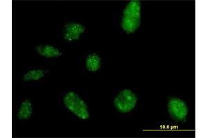 Immunofluorescence of purified MaxPab antibody to NARG2 on HeLa cell. (NARG2 anticorps  (AA 1-332))