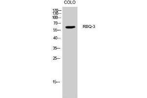 Western Blotting (WB) image for anti-Retinoblastoma Binding Protein 5 (RBBP5) (Internal Region) antibody (ABIN3177167) (RBBP5 anticorps  (Internal Region))