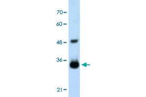 Western Blot analysis of transfected 293T cell lysate with HOXC9 polyclonal antibody  at 2. (HOXC9 anticorps  (Internal Region))