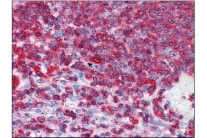 Human Spleen: Formalin-Fixed, Paraffin-Embedded (FFPE) (GDI2 anticorps)