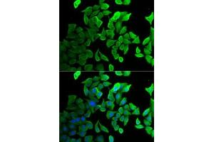 Immunofluorescence analysis of U2OS cells using Septin 2 antibody (ABIN6128758, ABIN6147552, ABIN6147553 and ABIN6221486).