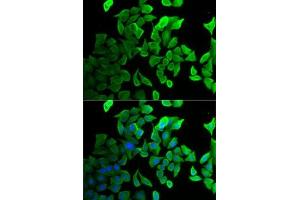 Immunofluorescence analysis of U2OS cells using Septin 2 antibody (ABIN6128758, ABIN6147552, ABIN6147553 and ABIN6221486). (Septin 2 anticorps  (AA 112-361))