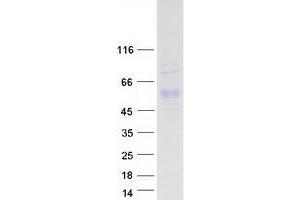 Validation with Western Blot