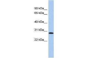 WB Suggested Anti-LYSMD1 Antibody Titration: 0. (LYSMD1 anticorps  (N-Term))