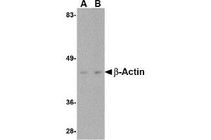 Western Blotting (WB) image for anti-Actin, beta (ACTB) (C-Term) antibody (ABIN1030291) (beta Actin anticorps  (C-Term))