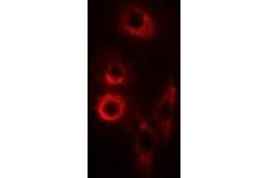Immunofluorescent analysis of SMAC staining in SW620 cells. (DIABLO anticorps)
