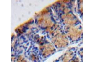 Used in DAB staining on fromalin fixed paraffin-embedded Bowels tissue (MANF anticorps  (AA 28-182))
