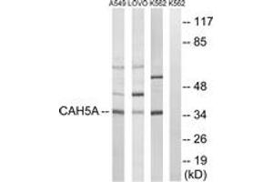 Western blot analysis of extracts from A549/LOVO/K562 cells, using CA5A Antibody. (CA5A anticorps  (AA 171-220))