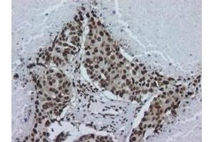 Image no. 2 for anti-Heterogeneous Nuclear Ribonucleoprotein A2/B1 (HNRNPA2B1) antibody (ABIN108621)