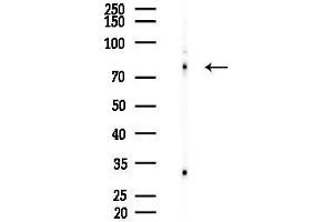 anti-Integrin beta-8 (ITGB8) (Internal Region) antibody