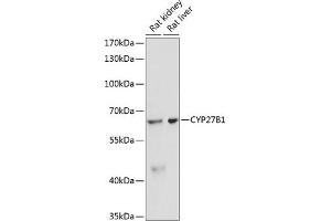 Western blot analysis of extracts of various cell lines, using CYP27B1 antibody (ABIN6130955, ABIN6139327, ABIN6139328 and ABIN6218814) at 1:3000 dilution. (CYP27B1 anticorps  (AA 25-195))