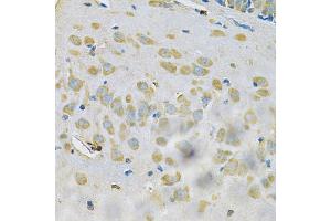 Immunohistochemistry of paraffin-embedded rat brain using SAR1A Antibody (ABIN4905086) at dilution of 1:100 (40x lens). (SAR1A anticorps)