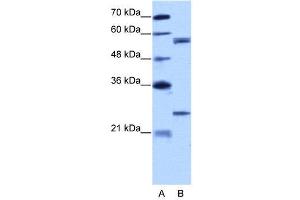WB Suggested Anti-CPNE1  Antibody Titration: 5. (CPNE1 anticorps  (N-Term))