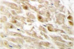 Immunohistochemistry (IHC) analyzes of PEBP2beta antibody in paraffin-embedded human heart tissue. (CBFB anticorps)