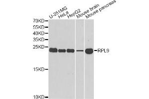 Western blot analysis of extracts of various cell lines, using RPL9 antibody (ABIN5973807) at 1/1000 dilution. (RPL9 anticorps)