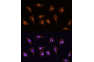 Immunofluorescence analysis of L929 using KDM5B antibody (ABIN6132287, ABIN6142802, ABIN6142803 and ABIN6223724) at dilution of 1:100 (40x lens).