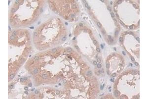 Detection of ASAH1 in Human Kidney Tissue using Polyclonal Antibody to N-Acylsphingosine Amidohydrolase 1 (ASAH1)