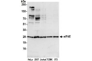 Western Blotting (WB) image for anti-Eukaryotic Translation Initiation Factor 4E (EIF4E) (AA 1-50) antibody (ABIN7450202)