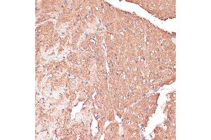 Immunohistochemistry of paraffin-embedded Mouse heart using FRMD6 antibody (ABIN6132194, ABIN6140773, ABIN6140774 and ABIN6225347) at dilution of 1:100 (40x lens). (FRMD6 anticorps  (AA 405-614))