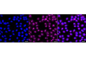 anti-Fibrillarin (FBL) antibody