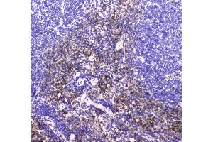 IHC analysis of NCR1 using anti-NCR1 antibody .
