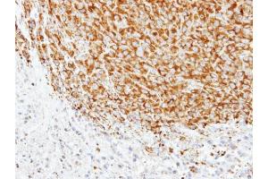 IHC-P Image Immunohistochemical analysis of paraffin-embedded SAS xenograft, using alpha Tubulin 1A, antibody at 1:500 dilution. (TUBA1A anticorps)