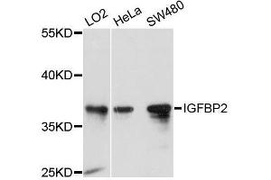 Western blot analysis of extracts of various cell lines, using IGFBP2 antibody. (IGFBP2 anticorps  (AA 100-200))